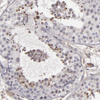 Anti-ITIH4 Antibody