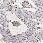 Immunohistochemical staining of human testis shows moderate cytoplasmic positivity in spermatids.