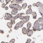 Immunohistochemical staining of human placenta shows moderate membranous/ cytoplasmic positivity in trophoblastic cells.