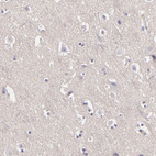 Anti-EGFL6 Antibody