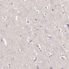 Immunohistochemical staining of human cerebral cortex shows no positivity in neurons as expected.