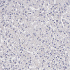 Immunohistochemical staining of human liver shows no positivity in hepatocytes as expected.