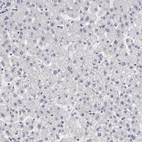 Immunohistochemical staining of human liver shows no positivity in hepatocytes as expected.