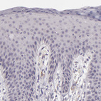 Immunohistochemical staining of human skin shows no positivity in squamous epithelial cells as expected.