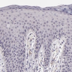 Immunohistochemical staining of human skin shows no positivity in squamous epithelial cells as expected.