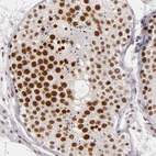 Anti-BRD8 Antibody