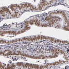 Immunohistochemical staining of human fallopian tube shows strong nuclear positivity in glandular cells.