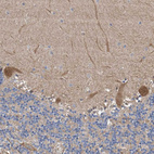 Anti-PTK2 Antibody