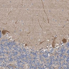 Anti-PTK2 Antibody