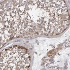 Immunohistochemical staining of human testis shows moderate to cytoplasmic positivity in spermatogonia and Leydig cells.