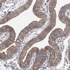 Immunohistochemical staining of human fallopian tube shows moderate cytoplasmic and membranous positivity in glandular cells.