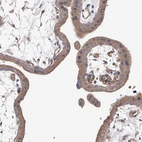Immunohistochemical staining of human placenta shows strong cytoplasmic positivity in trophoblastic cells.