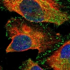 Immunofluorescent staining of human cell line U-2 OS shows localization to cytosol & focal adhesion sites.