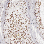Immunohistochemical staining of human testis shows moderate nuclear positivity in cells in seminiferous ducts.