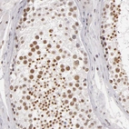 Immunohistochemical staining of human testis shows moderate nuclear positivity in cells in seminiferous ducts.