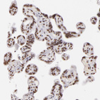 Anti-INTS6 Antibody