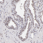 Anti-INTS6 Antibody