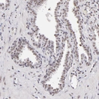 Immunohistochemical staining of human prostate shows weak nuclear positivity in glandular cells.