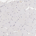 Anti-INTS6 Antibody