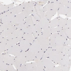 Immunohistochemical staining of human skeletal muscle shows low positivity in myocytes as expected.