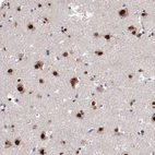 Immunohistochemical staining of human cerebral cortex shows high expression.