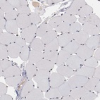 Immunohistochemical staining of human skeletal muscle shows low expression as expected.