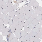 Immunohistochemical staining of human skeletal muscle shows low expression as expected.