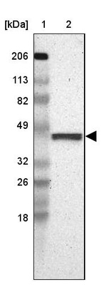 Anti-FAM81A Antibody