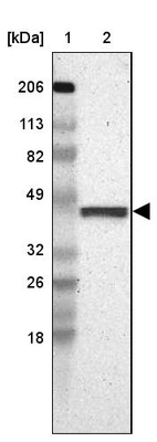 Lane 1: Marker [kDa] 206, 113, 82, 49, 32, 26, 18_br/_Lane 2: Human cell line RT-4