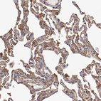 Anti-TMOD3 Antibody