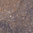 Immunohistochemical staining of human lymph node shows strong cytoplasmic positivity in non-germinal center cells.