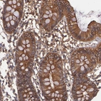 Immunohistochemical staining of human colon shows strong cytoplasmic positivity in glandular cells.
