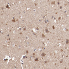 Immunohistochemical staining of human cerebral cortex shows strong cytoplasmic positivity in neurons.