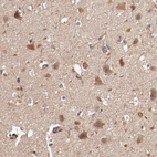 Immunohistochemical staining of human cerebral cortex shows strong cytoplasmic positivity in neurons.