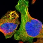 Immunofluorescent staining of human cell line U-2 OS shows localization to cytosol & actin filaments.