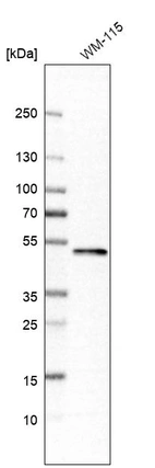 Western blot analysis in human cell line WM-115.