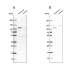 Western blot analysis using Anti-SP1 antibody HPA001853 (A) shows similar pattern to independent antibody HPA012292 (B).