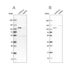Western blot analysis using Anti-SP1 antibody HPA001853 (A) shows similar pattern to independent antibody HPA012292 (B).