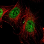 Immunofluorescent staining of human cell line U-251 MG shows localization to nucleoplasm.