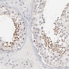 Anti-STAT4 Antibody