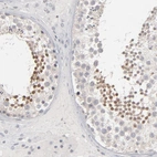 Immunohistochemical staining of human testis shows high expression.