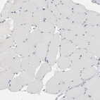 Immunohistochemical staining of human skeletal muscle shows low expression as expected.