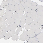 Immunohistochemical staining of human skeletal muscle shows low expression as expected.