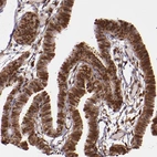 Immunohistochemical staining of human Fallopian tube shows moderate to strong nuclear and cytoplasmic positivity in glandular cells.