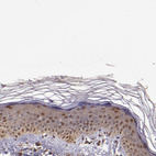 Immunohistochemical staining of human skin shows weak to moderate nuclear positivity in squamous epithelial cells.