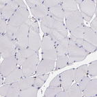 Anti-STAT6 Antibody