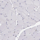 Immunohistochemical staining of human skeletal muscle shows no positivity in myocytes as expected.