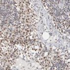 Anti-IRF9 Antibody