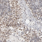 Anti-IRF9 Antibody