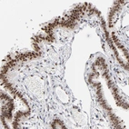 Immunohistochemical staining of human fallopian tube strong nuclear positivity in glandular cells.